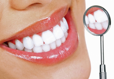 QUANTO TEMPO DURA A LENTE DE CONTATO DENTAL?